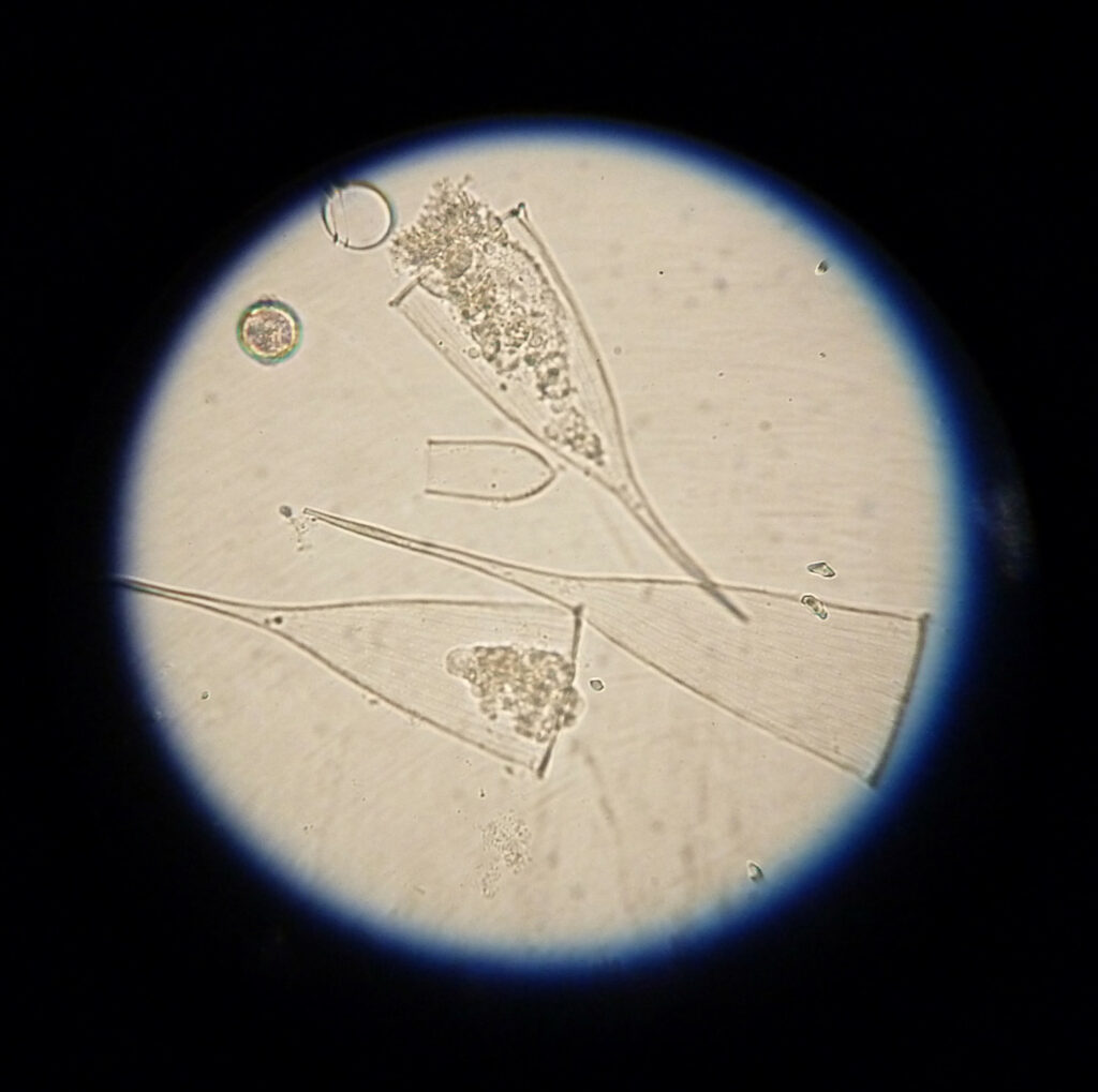 Œuvre de Mara G Haseltine : photographie de tintinnidés vue au microscope