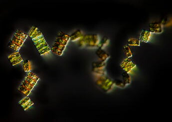 Micro-organismes : Diatomées