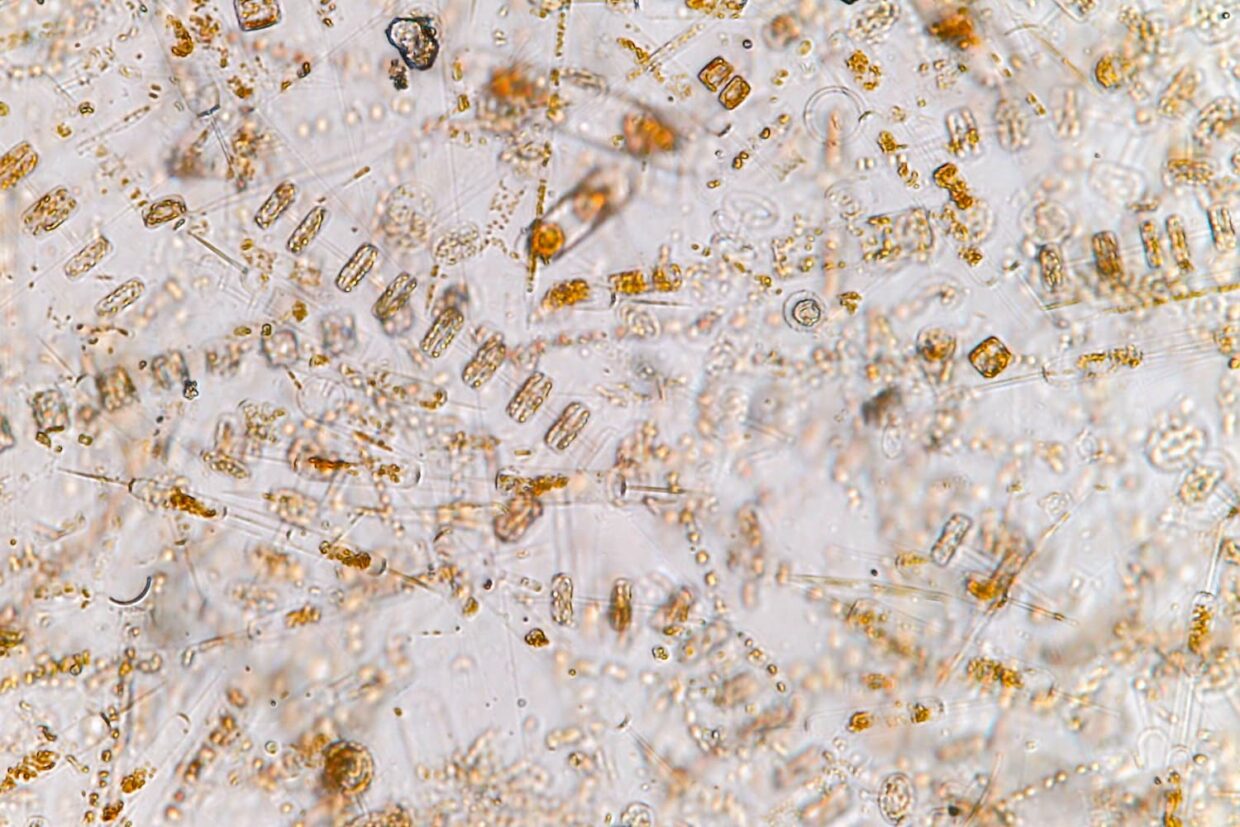 Micro-organismes sous microscope