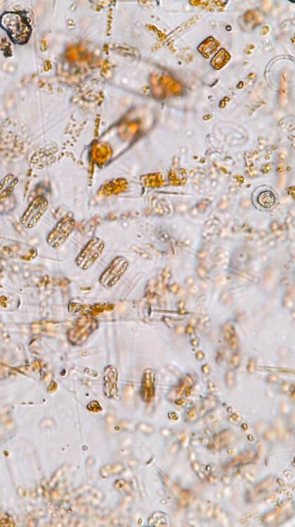 Micro-organismes sous microscope