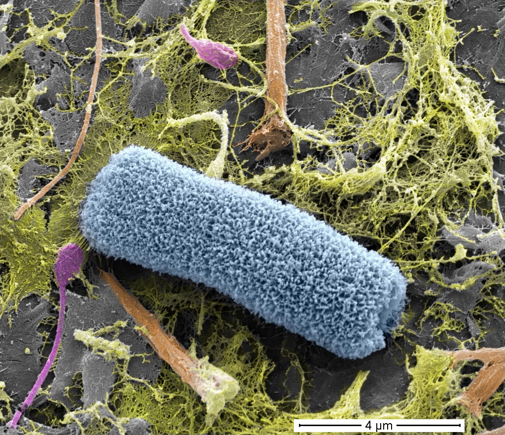 Les pathogènes vivent sur le microplastique